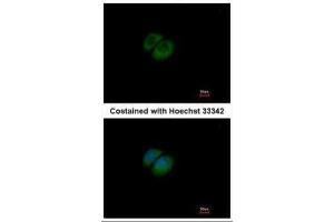 ICC/IF Image Immunofluorescence analysis of methanol-fixed A549, using HPRT, antibody at 1:500 dilution. (HPRT1 抗体)