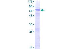 Image no. 1 for DnaJ (Hsp40) Homolog, Subfamily C, Member 18 (DNAJC18) (AA 1-358) protein (GST tag) (ABIN1351801) (DNAJC18 Protein (AA 1-358) (GST tag))