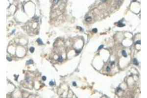 Immunohistochemical analysis of paraffin-embedded human fetal liver showing cytoplasmic staining with ABCF3 polyclonal antibody  at a 1 : 100 dilution. (ABCF3 抗体  (AA 442-681))
