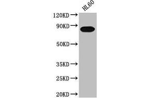 Western Blot Positive WB detected in: HL60 whole cell lysate All lanes: PREP antibody at 1:2000 Secondary Goat polyclonal to rabbit IgG at 1/50000 dilution Predicted band size: 81 kDa Observed band size: 81 kDa (PREP 抗体  (AA 539-691))