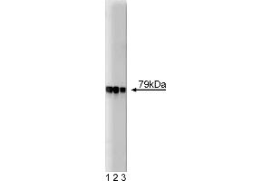 Western Blotting (WB) image for anti-A Kinase (PRKA) Anchor Protein 5 (AKAP5) (AA 180-427) antibody (ABIN967900) (AKAP5 抗体  (AA 180-427))