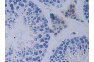 Immunohistochemistry (IHC) image for anti-Proprotein Convertase Subtilisin/kexin Type 1 (PCSK1) (AA 244-530) antibody (ABIN7443446)