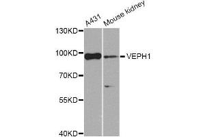 Western blot analysis of extracts of various cell lines, using VEPH1 Antibody (ABIN5974616) at 1/1000 dilution. (VEPH1 抗体)