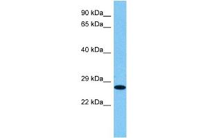 Host:  Rat  Target Name:  HMGB1  Sample Tissue:  Rat Skeletal Muscle  Antibody Dilution:  1ug/ml (HMGB1 抗体  (N-Term))
