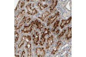 Immunohistochemical staining of human kidney with SUSD2 polyclonal antibody  show strong cytoplasmic and membranous positivity in cells in tubules at 1:200-1:500 dilution. (SUSD2 抗体)