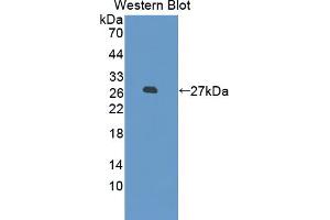 Western Blotting (WB) image for anti-Cysteine Dioxygenase, Type I (CDO1) (AA 1-200) antibody (ABIN5013420)