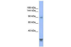 Western Blotting (WB) image for anti-Protein Phosphatase 2, Regulatory Subunit B'', alpha (PPP2R3A) (N-Term) antibody (ABIN2786686)