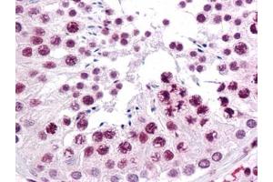 Immunohistochemistry (IHC) image for anti-Sirtuin 1 (SIRT1) (AA 456-555) antibody (ABIN614713) (SIRT1 抗体  (AA 456-555))