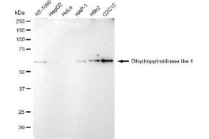 Western blotting analysis using Dihydropyrimidinase like 4 antibody (ABIN7798339).