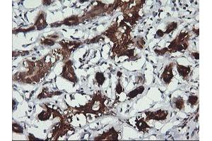 Image no. 2 for anti-butyrobetaine (Gamma), 2-Oxoglutarate Dioxygenase (Gamma-butyrobetaine Hydroxylase) 1 (BBOX1) antibody (ABIN1496819) (BBOX1 抗体)