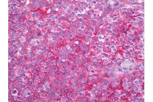 Anti-B2M antibody IHC of human tonsil.