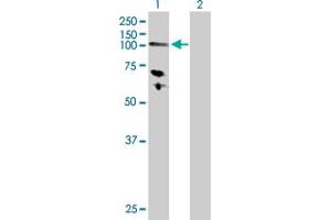 Western Blot analysis of HK3 expression in transfected 293T cell line by HK3 MaxPab polyclonal antibody. (HK3 抗体  (AA 1-923))