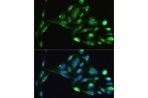 Immunofluorescence (IF) image for anti-Vimentin (VIM) (AA 1-101) antibody (ABIN6150108)