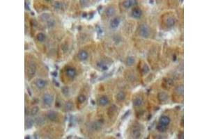 Used in DAB staining on fromalin fixed paraffin-embedded Liver tissue (ALDH7A1 抗体  (AA 29-539))