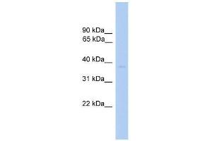 ST6GALNAC6 antibody used at 0. (ST6GALNAC6 抗体  (N-Term))
