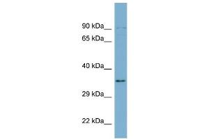 WB Suggested Anti-UBXN1  Antibody Titration: 0. (UBXN1 抗体  (Middle Region))
