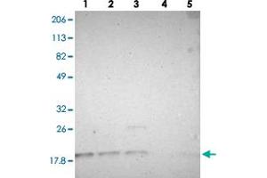 Western blot analysis of lane 1: RT-4, lane 2: U-251 MG, lane 3: A-431, lane 4: Liver and lane 5: Tonsil using SUB1 polyclonal antibody . (SUB1 抗体)