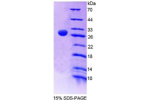 SDS-PAGE analysis of Rat FMO2 Protein. (FMO2 蛋白)