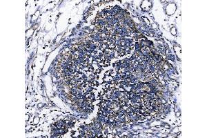IHC analysis of TOMM70 using anti-TOMM70 antibody (ABIN7599855). (TOM70 抗体  (AA 122-608))