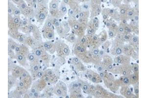 Detection of DVL1 in Human Liver Tissue using Polyclonal Antibody to Dishevelled, Dsh Homolog 1 (DVL1) (DVL1 抗体  (AA 150-285))