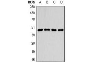 Western blot analysis of PDCD2L expression in MCF7 (A), SKOV3 (B), mouse brain (C), mouse heart (D) whole cell lysates. (PDCD2L 抗体)