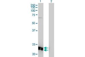 Western Blotting (WB) image for anti-Melanoregulin (MREG) (AA 1-214) antibody (ABIN565903)