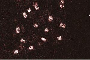 Immunofluorescent staining of HeLa cells with anti-GMAP-210. (Thyroid Hormone Receptor Interactor 11 (TRIP11) (AA 159-365) 抗体)