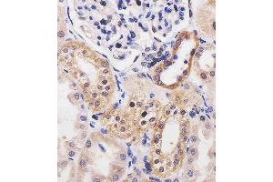 (ABIN6242147 and ABIN6577254) staining ADK in human kidney tissue sections by Immunohistochemistry (IHC-P - paraformaldehyde-fixed, paraffin-embedded sections). (ADK 抗体  (AA 1-345))