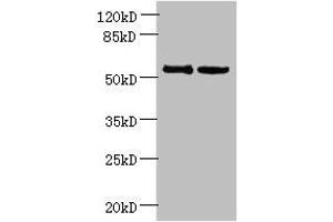 Western blot All lanes: UTP15 antibody at 5 μg/mL Lane 1: Hela whole cell lysate Lane 2: HepG2 whole cell lysate Secondary Goat polyclonal to rabbit IgG at 1/10000 dilution Predicted band size: 59, 37, 57 kDa Observed band size: 59 kDa (UTP15 抗体  (AA 234-518))