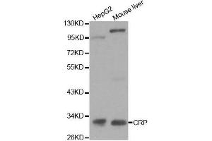 Western Blotting (WB) image for anti-C-Reactive Protein (CRP) (AA 1-224) antibody (ABIN3020716) (CRP 抗体  (AA 1-224))