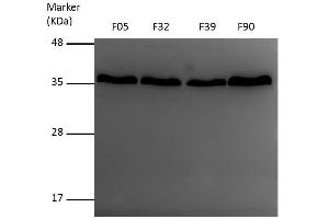 WB Image Sample (30 ug of whole cell lysate) A: A431 , 12% SDS PAGE VDAC1 antibody antibody diluted at 1:1000 (VDAC1 抗体)