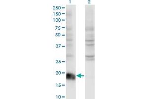 Western Blot analysis of ARF6 expression in transfected 293T cell line by ARF6 monoclonal antibody (M01A), clone 2A4.
