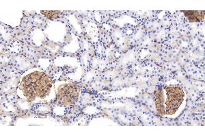 Detection of PODXL in Rat Kidney Tissue using Polyclonal Antibody to Podocalyxin (PODXL) (PODXL 抗体  (AA 408-485))