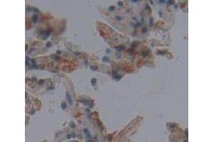 IHC-P analysis of Human Tissue, with DAB staining. (Peroxiredoxin 3 抗体  (AA 5-233))
