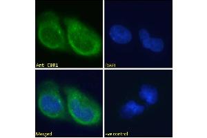 Immunofluorescence (IF) image for anti-Carbonyl Reductase 1 (CBR1) (C-Term) antibody (ABIN184784)