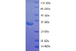 SDS-PAGE (SDS) image for Arginine Vasopressin Receptor 1A (AVPR1A) (AA 7-52), (partial) protein (GST tag) (ABIN5712990) (AVPR1A Protein (AA 7-52, partial) (GST tag))