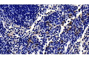 Detection of TLR4 in Rat Lymph node Tissue using Polyclonal Antibody to Toll Like Receptor 4 (TLR4)