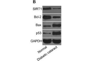 Expression of miR-211 and mRNA and protein expressions of SIRT1, Bcl-2, Bax, and p53 in lens tissues of mice(A) miR-211 expression and mRNA and protein expressions of SIRT1, Bcl-2, Bax, and p53 in mice lens, (B) strip chart of SIRT1, Bcl-2, Bax, and p53 proteins, (C) expressions of SIRT1, Bcl-2, Bax, and p53 proteins in mice lens, *, P<0. (p53 抗体  (AA 1-393))