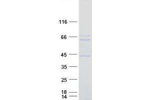 Western Blotting (WB) image for Retinoic Acid Induced 2 (RAI2) protein (Myc-DYKDDDDK Tag) (ABIN2730428)