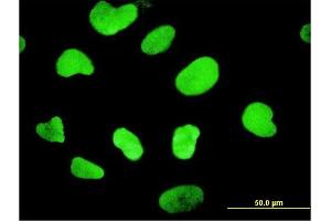 Immunofluorescence of monoclonal antibody to HMGB1 on HeLa cell. (HMGB1 抗体  (AA 1-215))