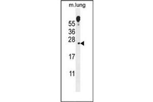 Western Blotting (WB) image for anti-Vesicular, Overexpressed in Cancer, Prosurvival Protein 1 (VOPP1) (AA 72-103), (Middle Region) antibody (ABIN955523)