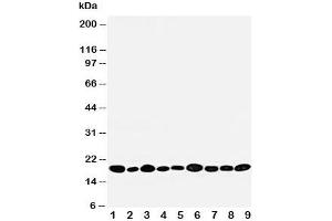 Western blot testing of NME2 antibody and rat samples 1: heart;  2: brain;  3: liver;  4: skeletal muscle;   and human samples 5: PANC;  6: HeLa;  7: SMMC-7721;  8: U87;  9: COLO320 cell lysate. (NME2 抗体  (AA 137-152))