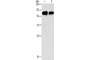 Western Blotting (WB) image for anti-Phosphatidylinositol-4-Phosphate 5-Kinase, Type I, gamma (PIP5K1C) antibody (ABIN2817276) (PIP5K1C 抗体)