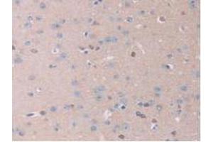 IHC-P analysis of Mouse Brain Tissue, with DAB staining. (IL13RA2 抗体  (AA 228-338))