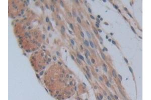 Immunohistochemistry (IHC) image for anti-phosphofructokinase, Platelet (PFKP) (AA 247-473) antibody (ABIN7443050)