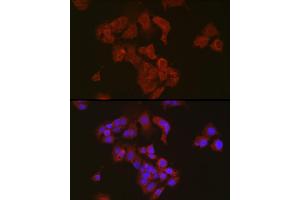 anti-Sterol Carrier Protein 2 (SCP2) antibody