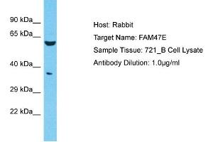 Host: Rabbit Target Name: FAM47E Sample Type: 721_B Whole Cell lysates Antibody Dilution: 1. (FAM47E 抗体  (C-Term))