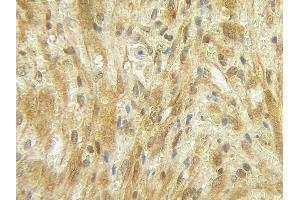 Immunohistochemistry (IHC) image for anti-Colony Stimulating Factor 3 (Granulocyte) (CSF3) antibody (Biotin) (ABIN2473720) (G-CSF 抗体  (Biotin))