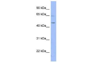 WB Suggested Anti-RNF12 Antibody Titration:  0. (RLIM 抗体  (N-Term))