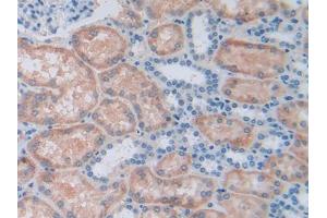 DAB staining on IHC-P; Samples: Human Kidney Tissue (ALDH7A1 抗体  (AA 1-539))